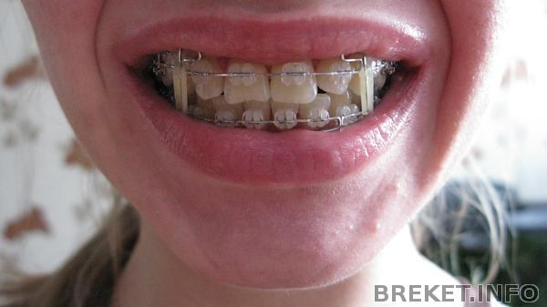 1 год 4,5 месяца