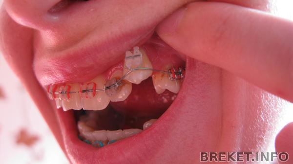 25.05.2012 25.05.2012