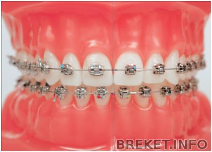 Damon vs обычный металл.jpg Damon vs обычный металл.jpg