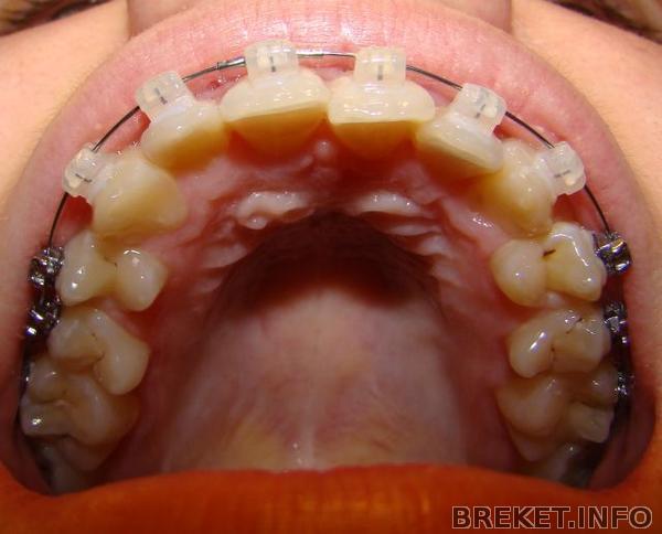 dsc00180.jpg dsc00180.jpg