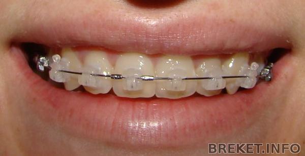 dsc00185.jpg dsc00185.jpg