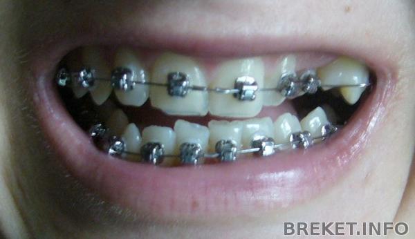 мой ужас, 2,5 месяца.jpg