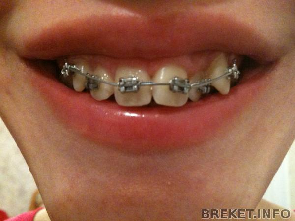 спустя 9 дней