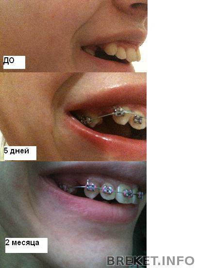 2_mes_1.jpg 2_mes_1.jpg