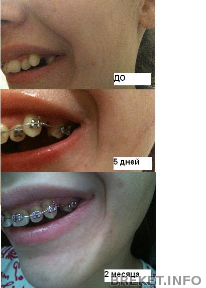 2_mes_2.jpg 2_mes_2.jpg