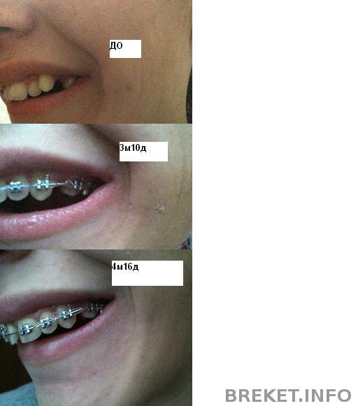 4m16d_2.jpg 4m16d_2.jpg