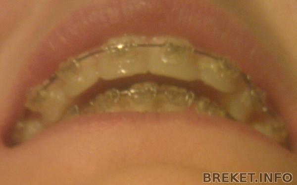 imag6385-1.jpg imag6385-1.jpg