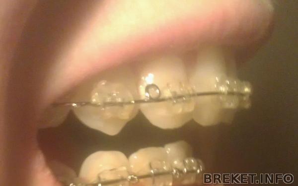 imag6386-1.jpg imag6386-1.jpg