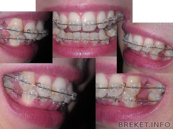 6 месяцев 19 дней вверх ,5 месяцев 10 дней низ