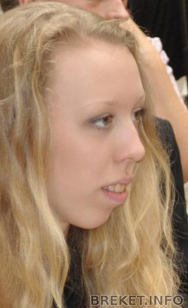 Мой ненавистный "почти профиль")