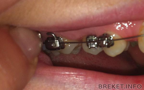 5ка без действий.jpg