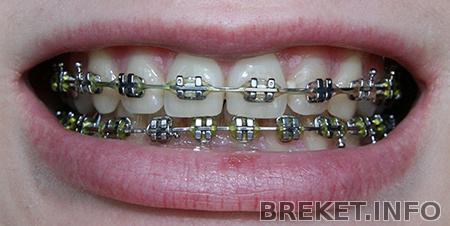 img_5833_13.jpg год и три