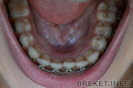 img_5736.jpg img_5736.jpg