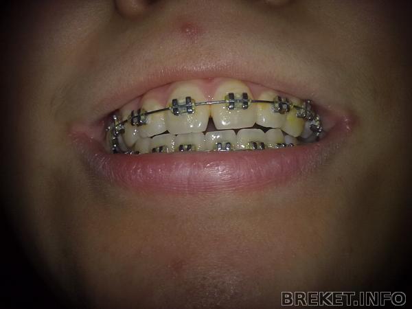 rrdzsrdz6051.jpg rrdzsrdz6051.jpg