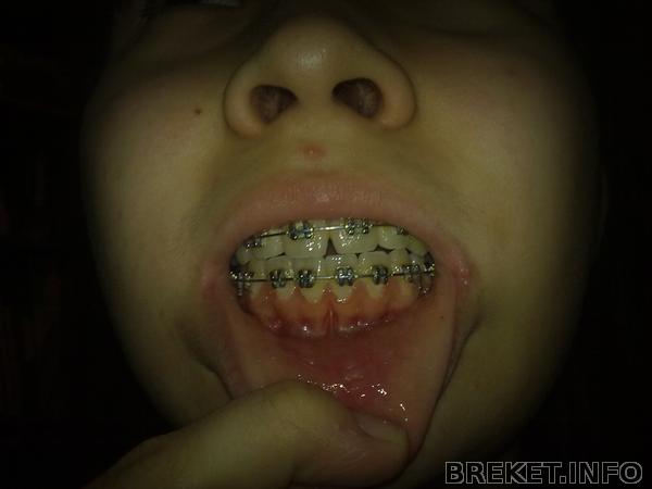 rrdzsrdz6041.jpg rrdzsrdz6041.jpg