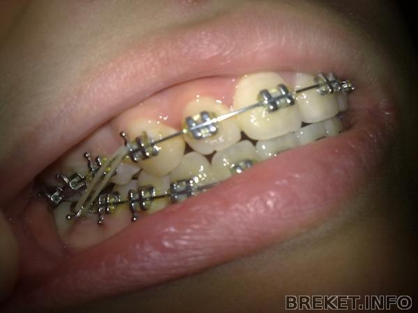 rrdzsrdz6081.jpg rrdzsrdz6081.jpg