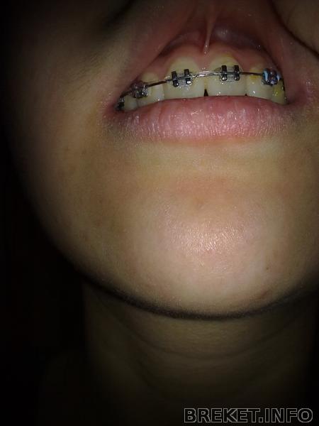 rrdzsrdz6221.jpg rrdzsrdz6221.jpg