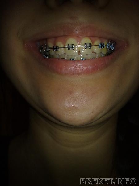 rrdzsrdz6231.jpg rrdzsrdz6231.jpg