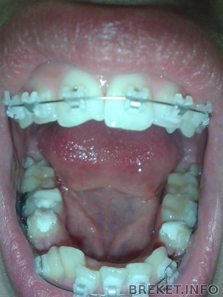 2012-10-02_12.34.45.jpg ВЧ 2мес 16 дней, НЧ установка