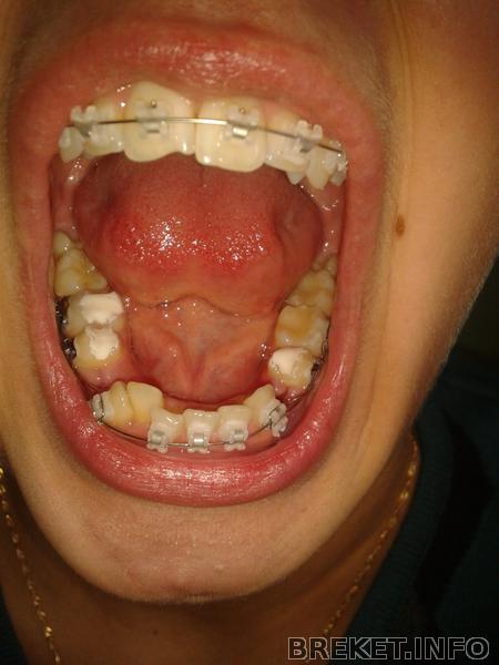 2012-10-02_12.31.40.jpg ВЧ 2 мес 16 дней, НЧ установка