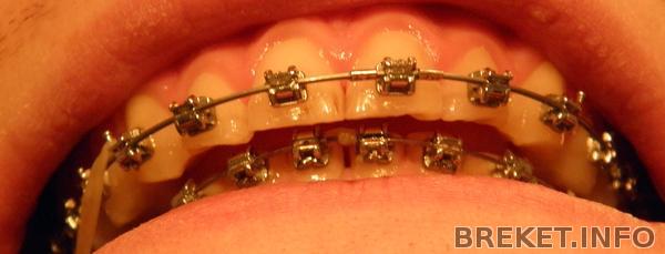 смотря с низу