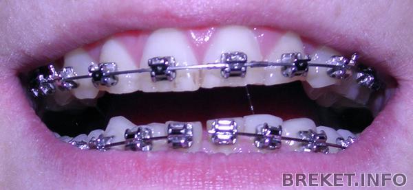 Дуга лопнула