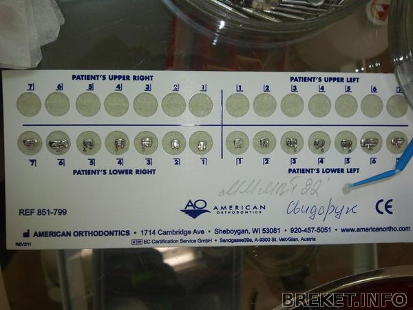 брекетульки