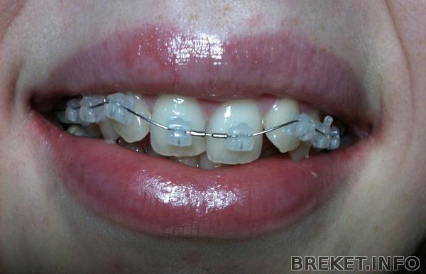 1 день 1 день