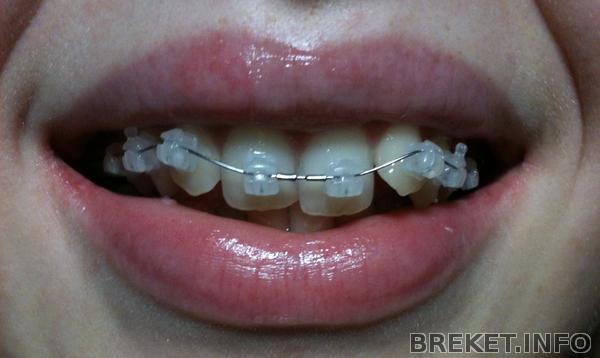 1 день 1 день