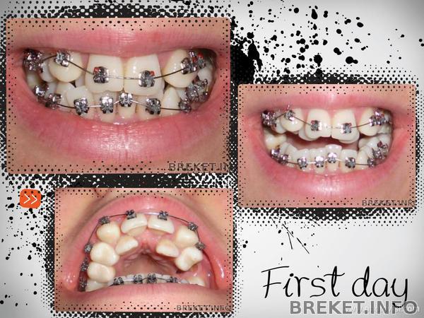 день установки.jpg