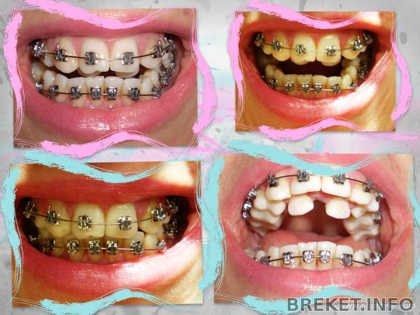 прошло 2 мес..jpg