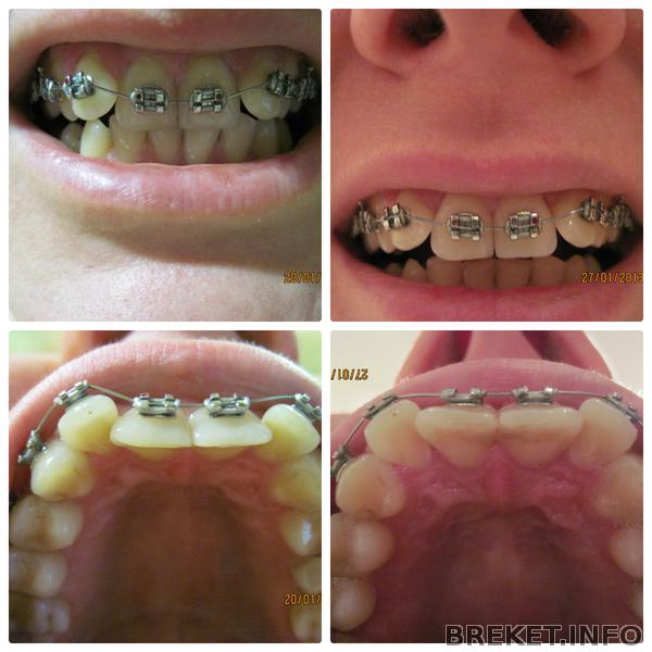 слева - 1 месяц 8 дней, справа 1 месяц 15 дней