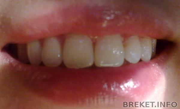 ix3ilj12vk4.jpg ix3ilj12vk4.jpg