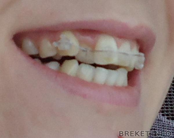 Вот такая картина у меня сейчас, после установки!!!!!!!!