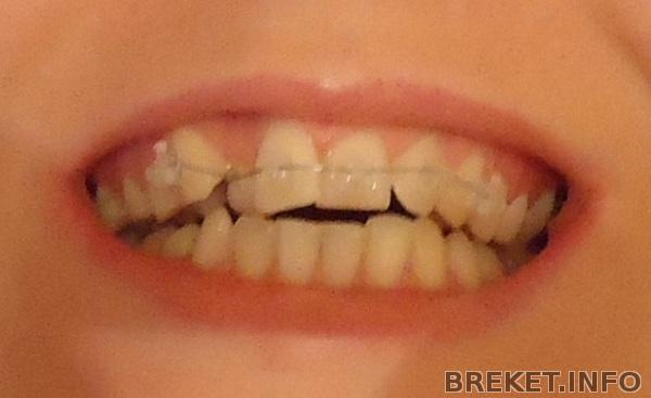 Ну вот, как-то так.......