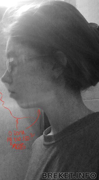 обогичтозакошмарсподбородком