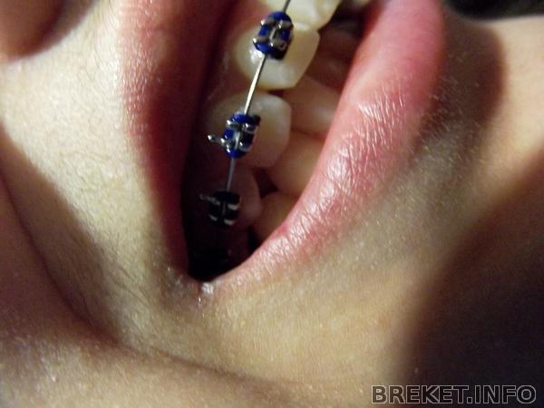 сорь что перевернуто но собосно щель=(