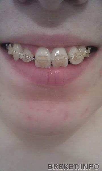 2 месяца 23 дня