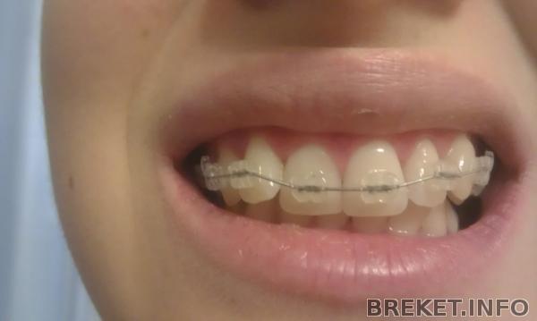 Первый день