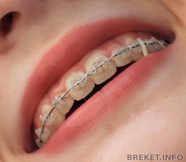 они разныеееее