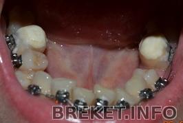 dsc_0032.jpg dsc_0032.jpg