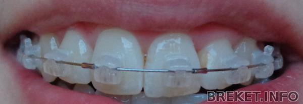 dsc01467.jpg dsc01467.jpg