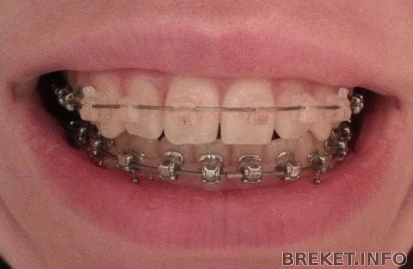 20140407_191536-1.gif