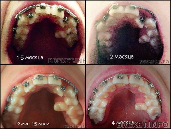 изменения на ВЧ