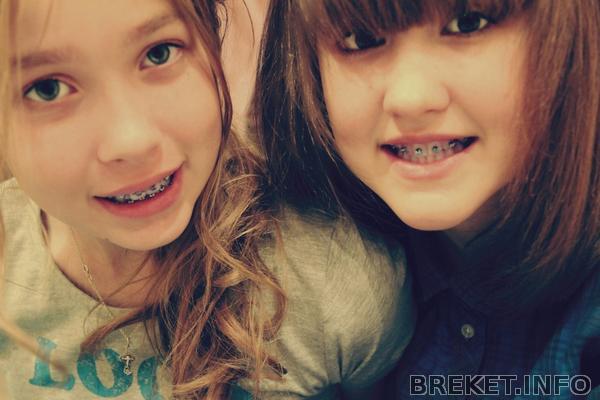 Брекетууули*-*