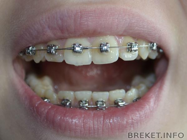 ВЧ-3 месяца,НЧ-2 месяца