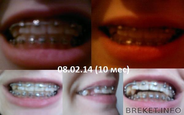 08.02.14 (10 мес)