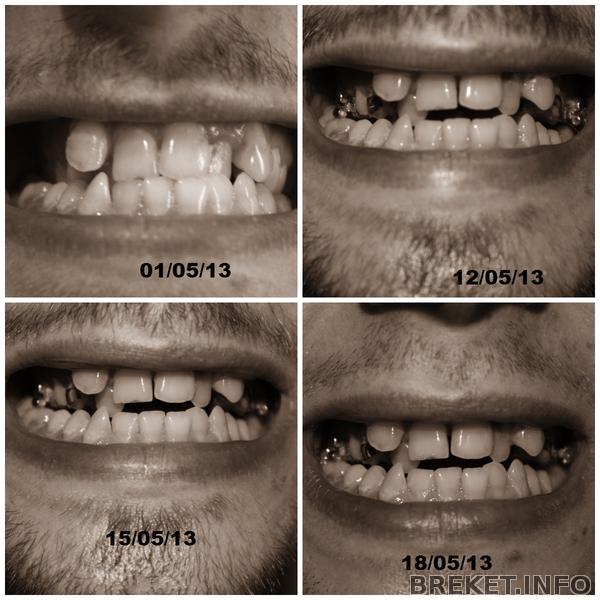 Расширение