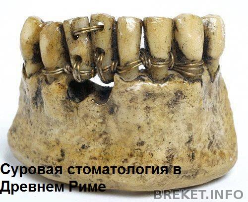 Суровая стоматология в Древнем Риме