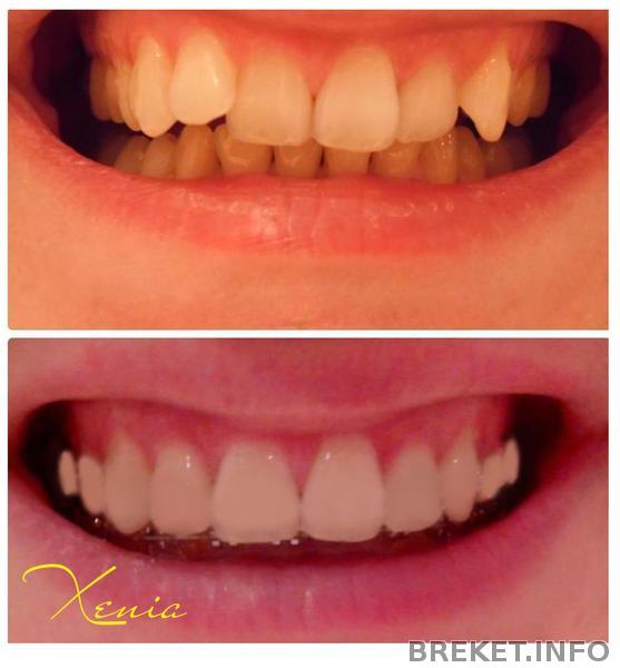 Xenia 7 месяцев